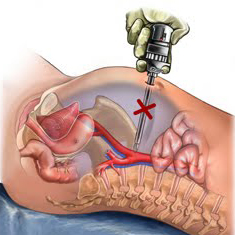 Paediatric Onco Surgery