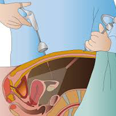 Paediatric Urology