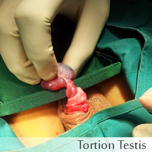 Tortion Testis