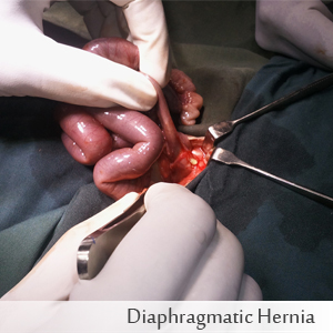 Diaphragmatic Hernia