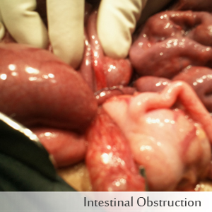 Intestinal Obstruction