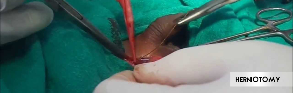 Laparoscopic and Neonatal Surgery