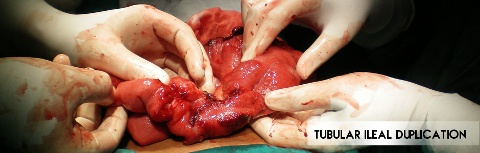 Neonatal Surgery